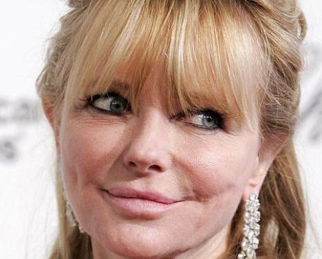 Cheryl Tiegs