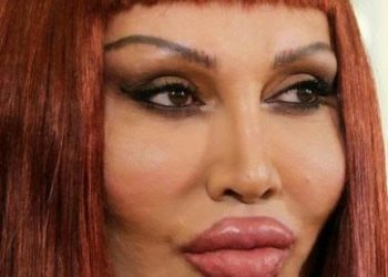 Pete Burns