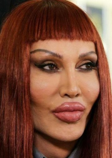 Pete Burns