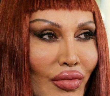 Pete Burns