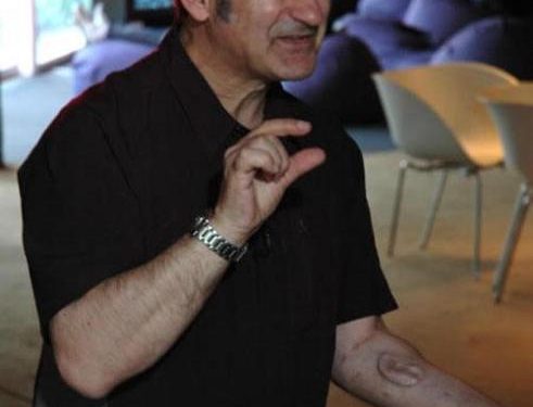 Stelarc