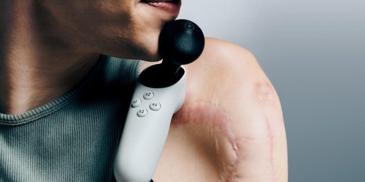 Yeni erişilebilir Xbox nunchuk kontrol cihazı 3D yazdırılabilir joystick parçalarına sahip.