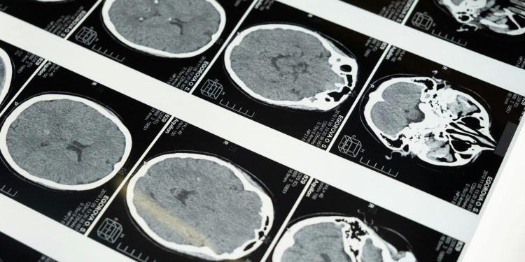 “AI Tıbbi Görüntüleme Modeli: Hızlı ve Ekonomik Uzman Analizi Sunuyor”