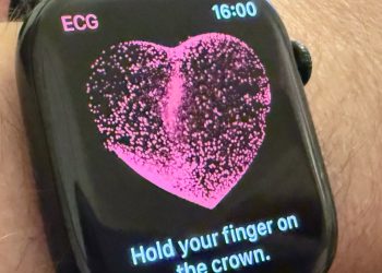 Apple Watch ve Apple Vision Pro kumaşlarına gömülü tıbbi sensörler eklenebilir