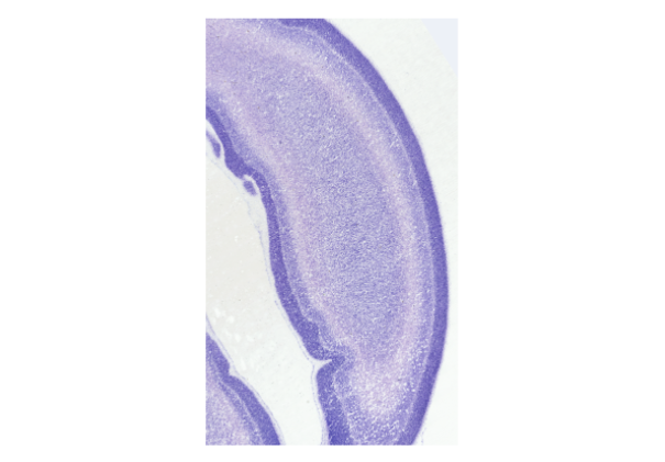 Image of the frontal cortex of the brain.