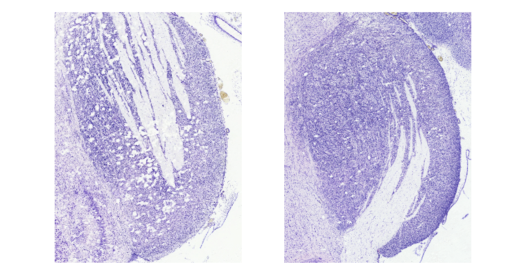 Two adjacent images of brain tissue, one image depicts an input sample stained purple, showcasing varied light and dark textures alongside several elongated lighter streaks. The other image displays a retrieved tissue sample that mirrors the shape, staining, and texture patterns of the input sample, highlighting the process of image-to-image retrieval.