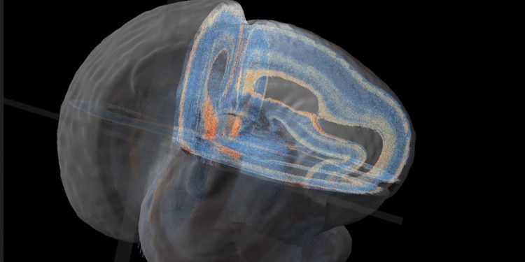 “Sinir Bilim Araştırmalarını Geliştiren Görsel Soru-Cevap ve Çok Modlu Veri Erişimi”