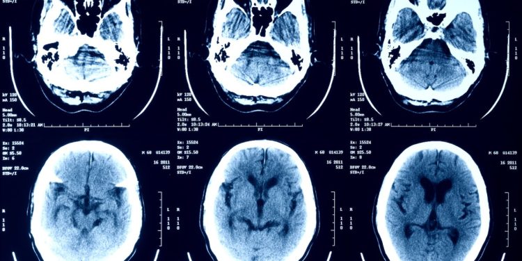 Dikkat: Tıbbi görüntülerinizi AI sohbet botlarına yüklemeyin!
