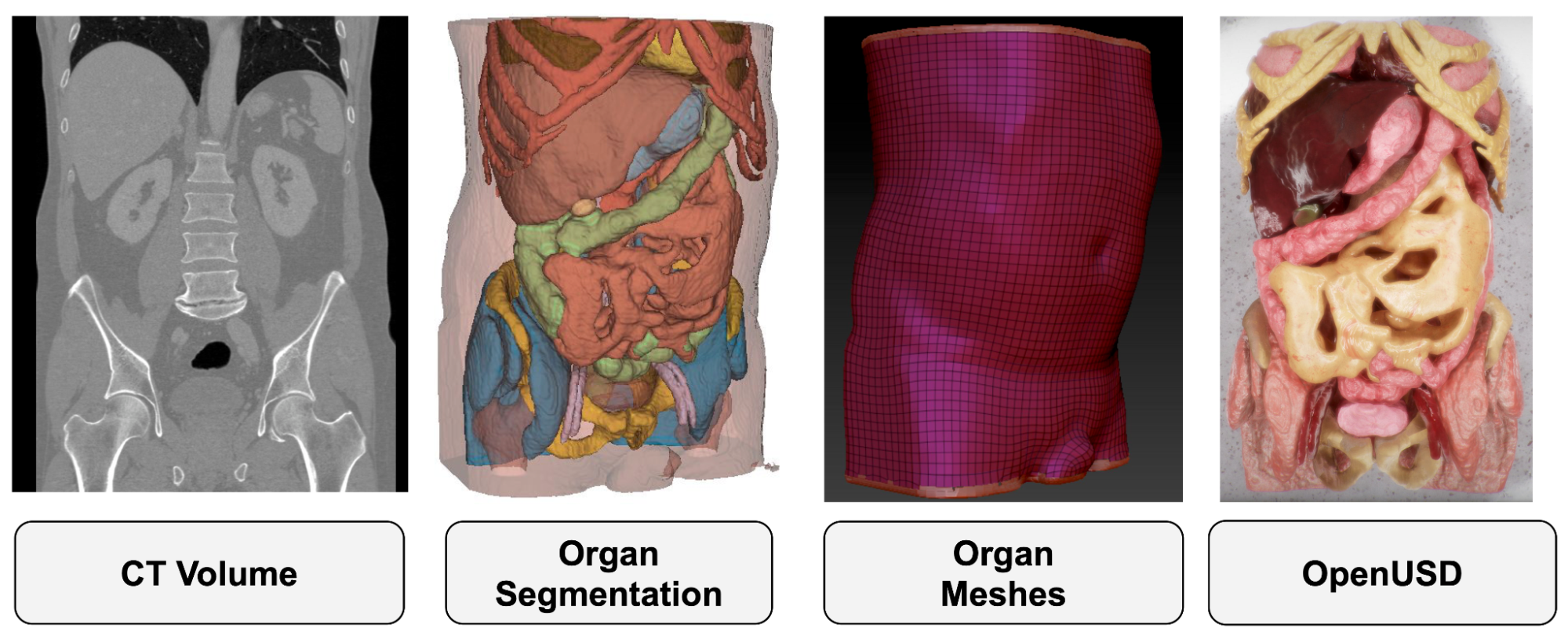 Four-part image showing (left to right) CT Volume, Organ Segmentation, Organ Meshes, and OpenUSD.