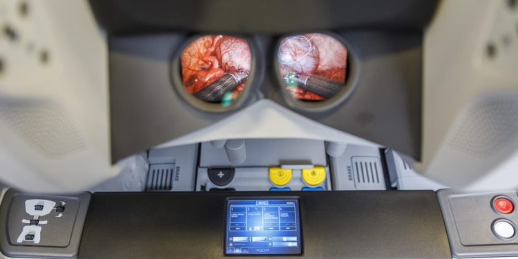 NVIDIA Holoscan ile Çoklu Modlu Görüntüleme Birleştirerek Gerçek Zamanlı Cerrahi Rehberlik