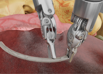 “AI Destekli Simülasyon ve Dijital İkiz Teknolojisi ile Cerrahi Robotik Alanında İlerleme”