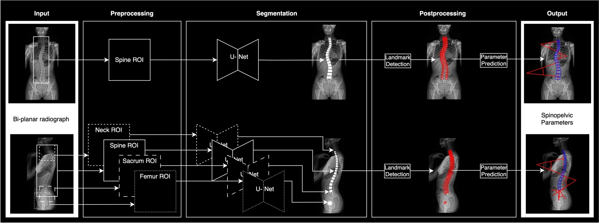 An illustration showing the workflow of the model for spinal predictions.