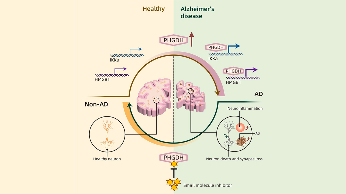 tb-alzheimers A bifurcated image depicting on one side a drawing of healthy brain cells. On the other side is an image of brain cells impacted by the PHGDH molecule, and a depiction of where Alzheimer’s disease is present.