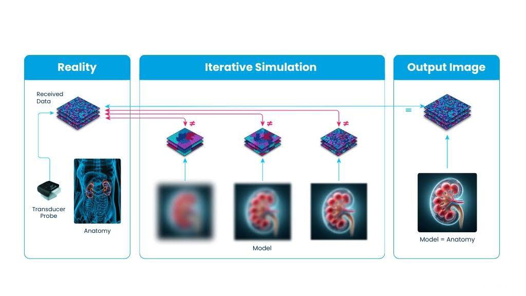 vortex-fig-3-cropped A schematic of the Full Waveform Inversion (FWI) process: an ultrasound transducer captures body anatomy data, which undergoes iterative simulation using cloud-based NVIDIA GPUs to match synthetic models with real-world data, producing an accurate diagnostic image.